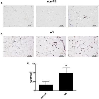 MiR-3064 in Epicardial Adipose-Derived Exosomes Targets Neuronatin to Regulate Adipogenic Differentiation of Epicardial Adipose Stem Cells